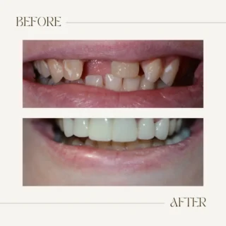Before and after restorative dental treatment